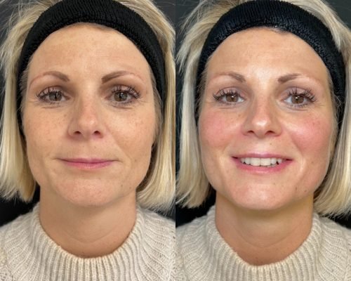 Forma-Before-After-1